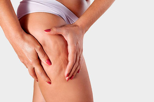 I migliori rimedi naturali contro la cellulite