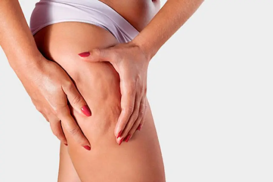 I migliori rimedi naturali contro la cellulite